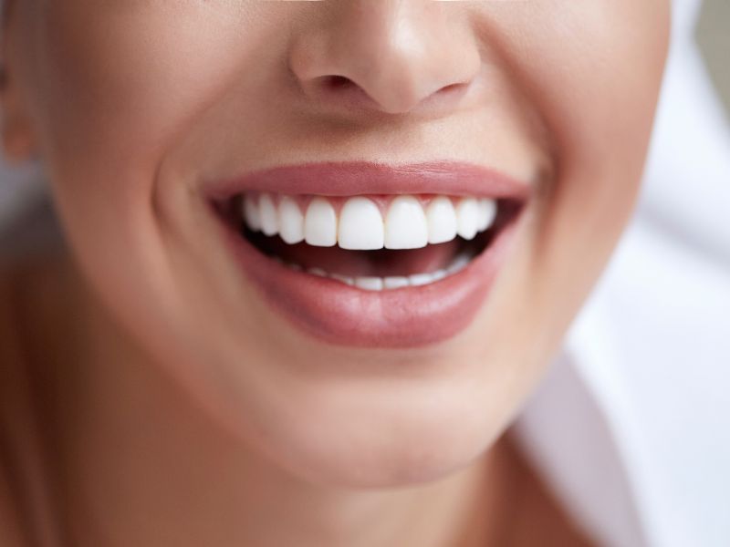 4 Tips on Getting a Healthy Smile